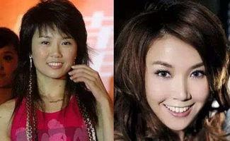 娱乐圈整容爆料 第3张 娱乐圈整容爆料 第3张